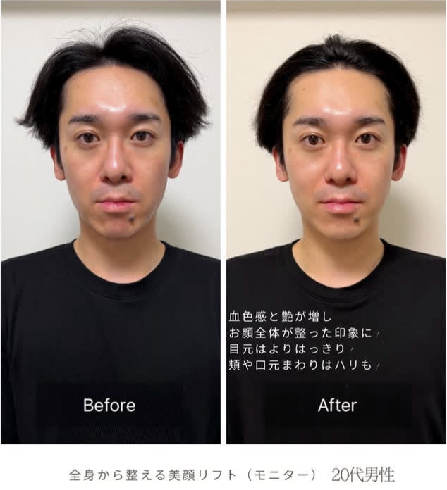 男性 正面 ビフォーアフター