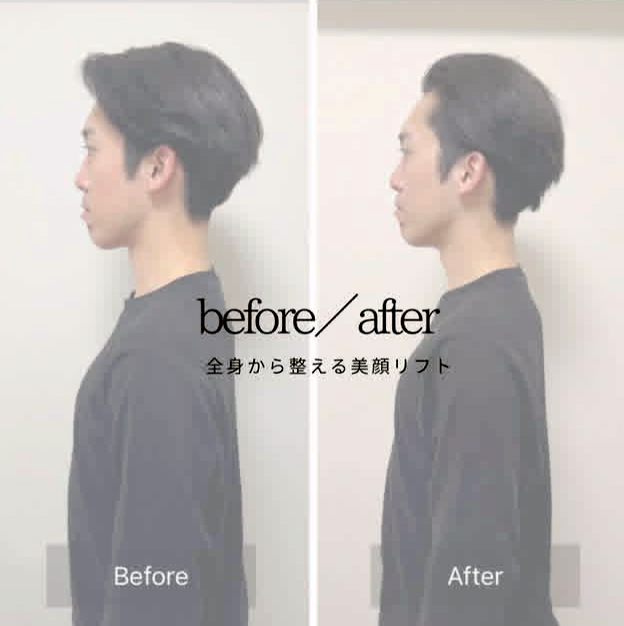 男性 横顔 ビフォーアフター