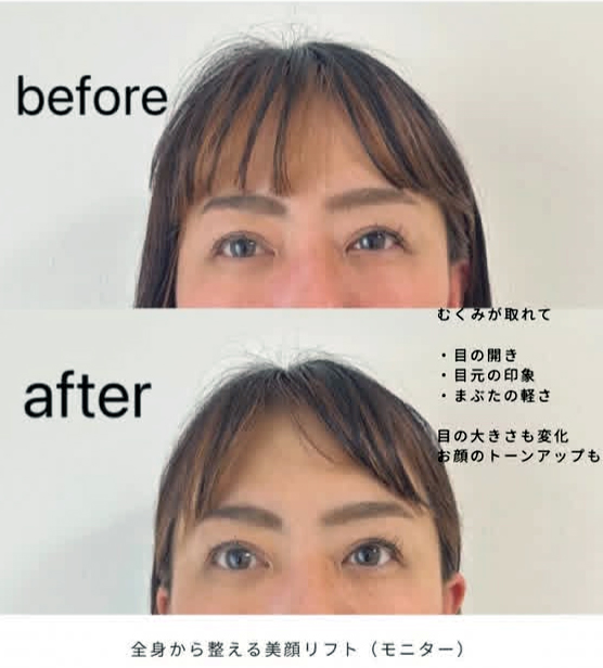 女性 目元 ビフォーアフター
